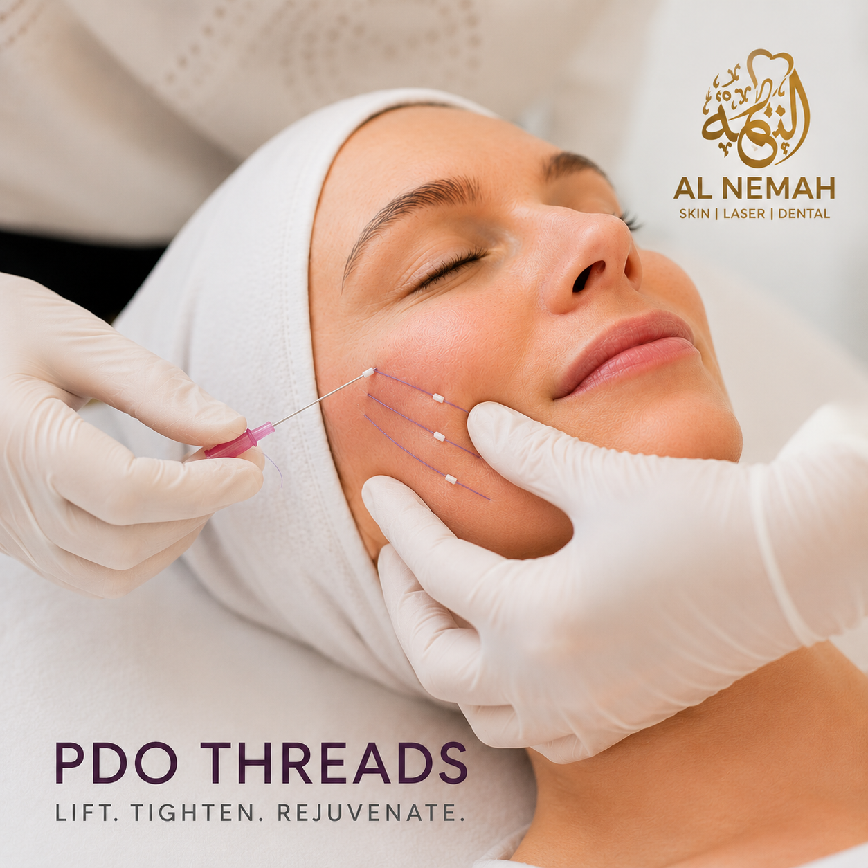 PDO Threads Treatment in Sharjah — Al Nemah Medical Center